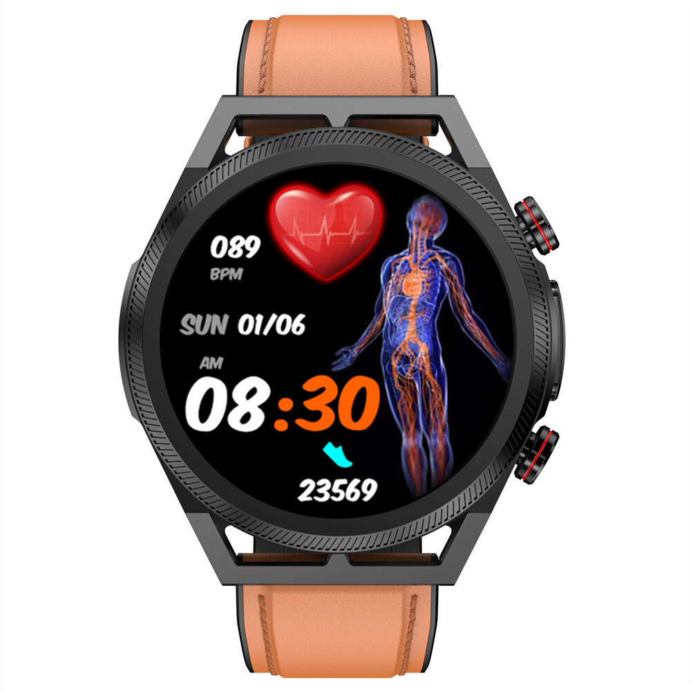 ET310 1.39 inch HD Screen Uric Acid Measurement bluetooth Call Heart Rate Blood Pressure Blood Lipid SpO2 Monitor ECG PPG Blood